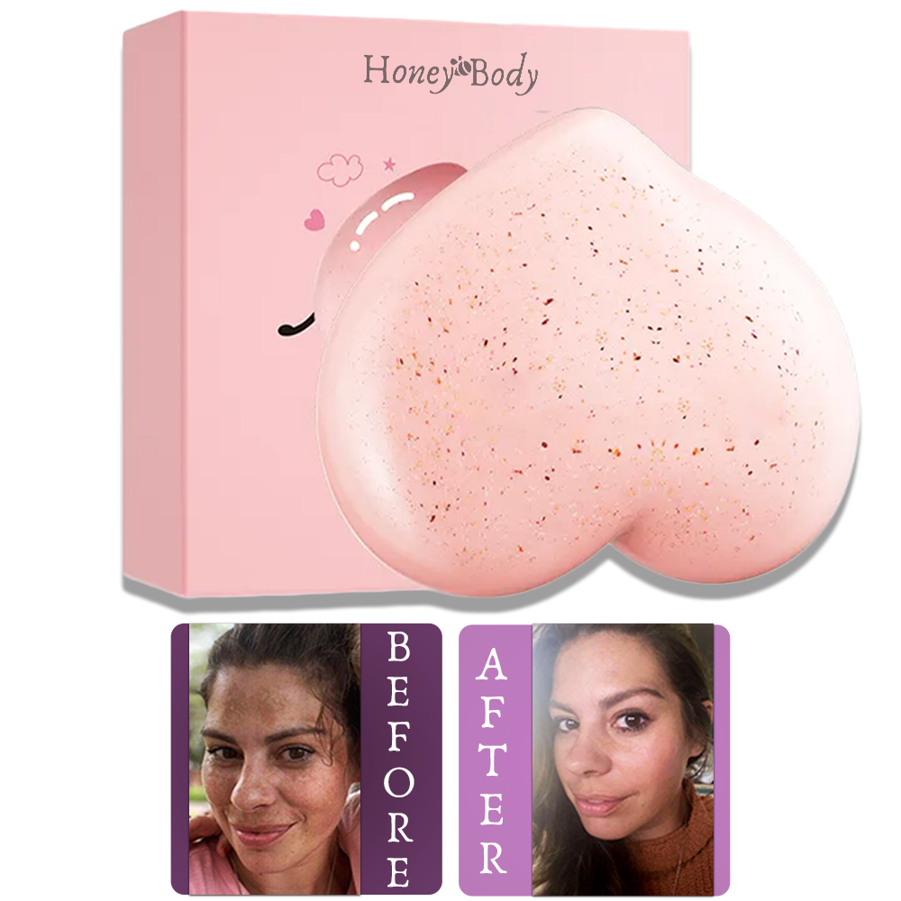 Soapy® Dark Spot Soap – Eliminate body spots & impurities naturally