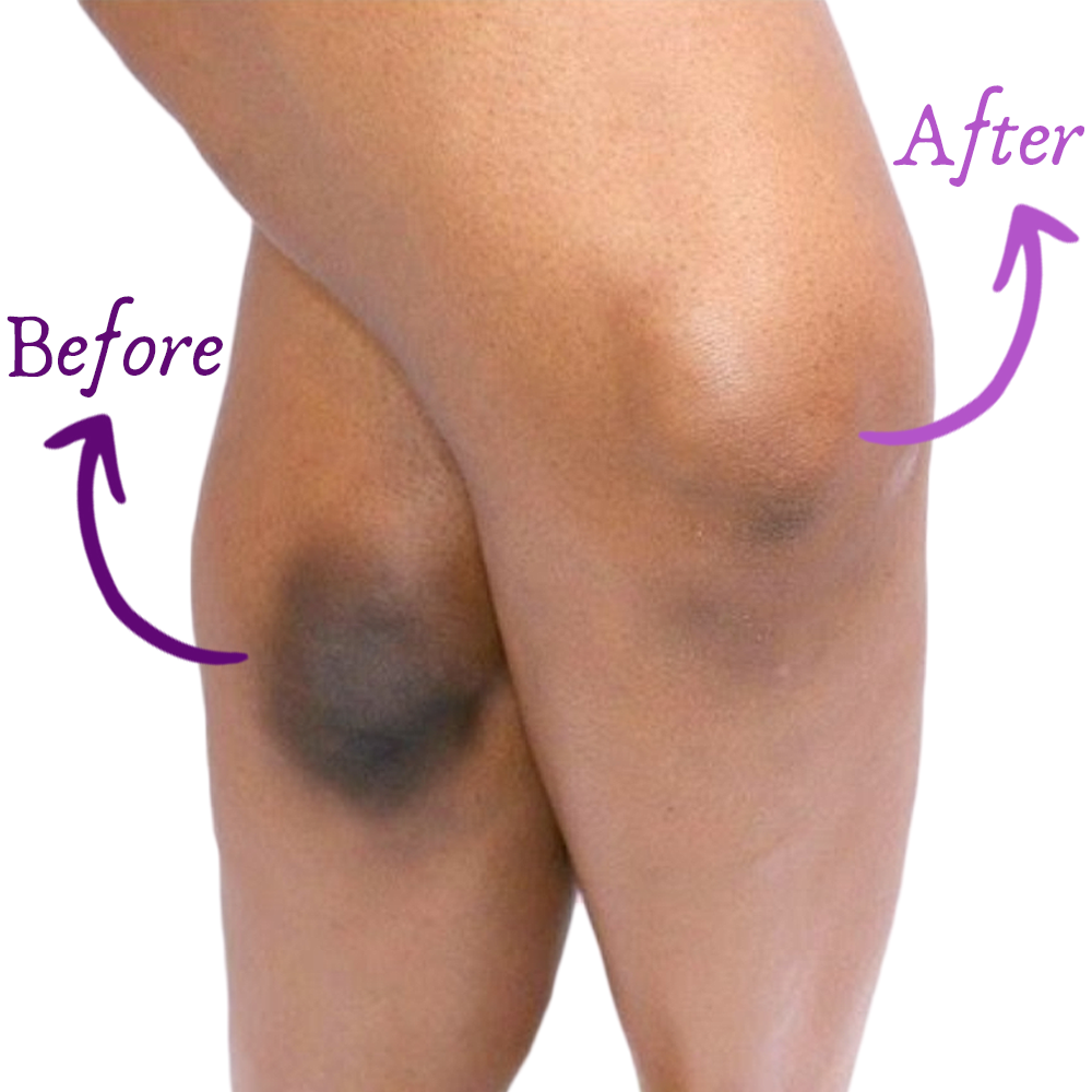 Soapy® Dark Spot Soap – Eliminate body spots & impurities naturally