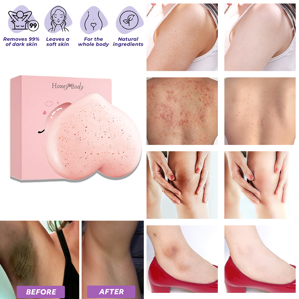 Soapy® Dark Spot Soap – Eliminate body spots & impurities naturally