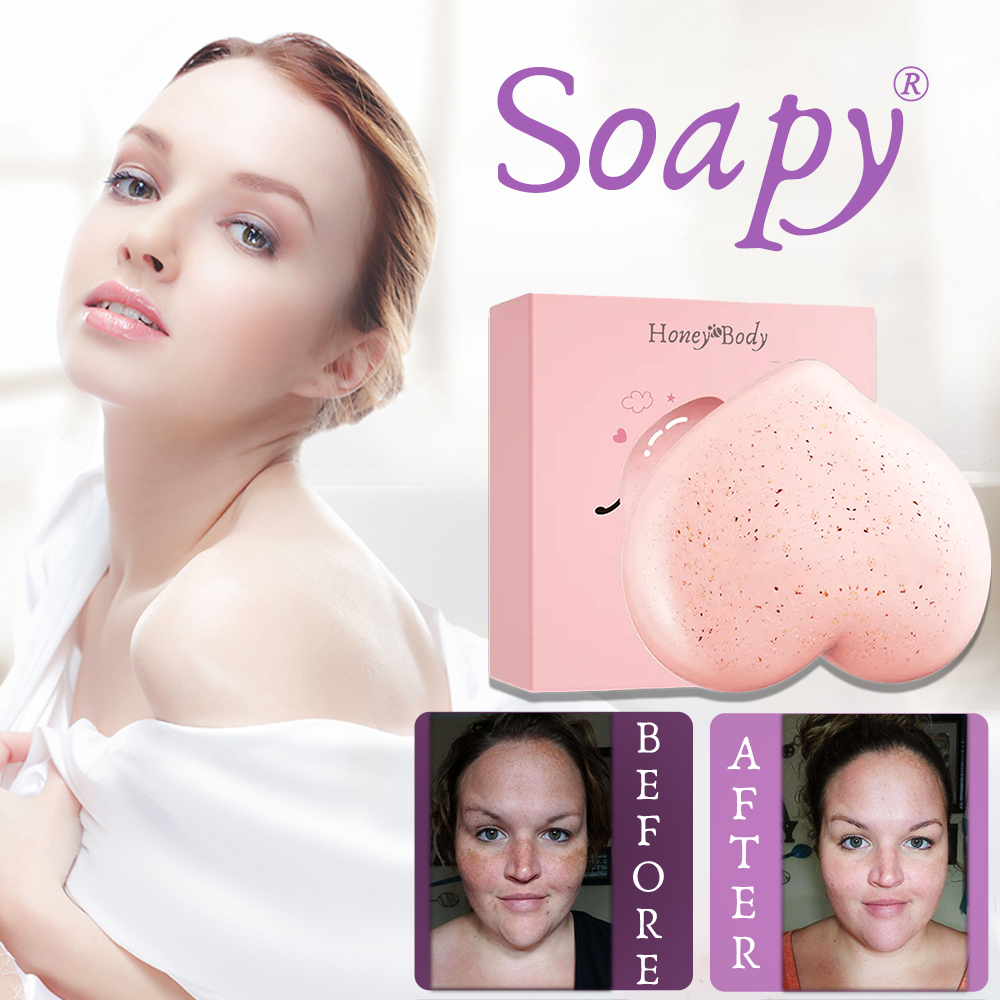 Soapy® Dark Spot Soap – Eliminate body spots & impurities naturally