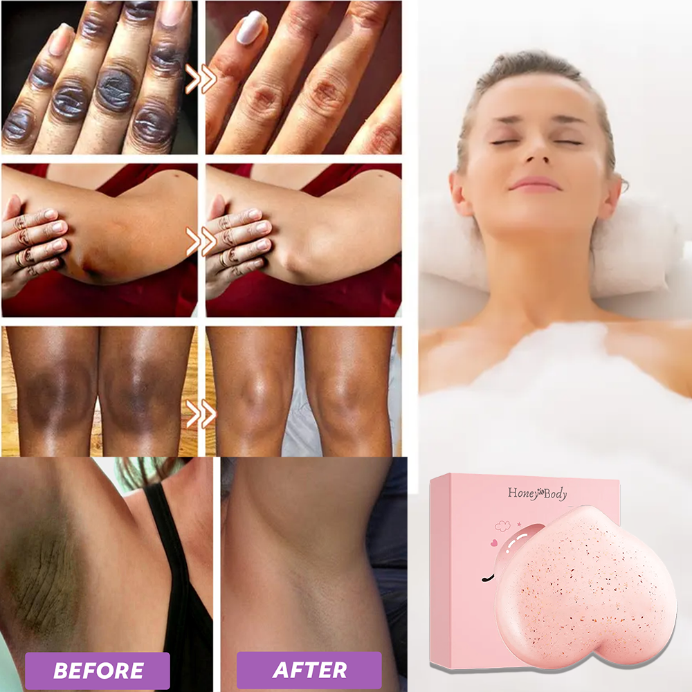 Soapy® Dark Spot Soap – Eliminate body spots & impurities naturally